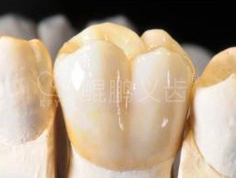威蘭德臻瓷